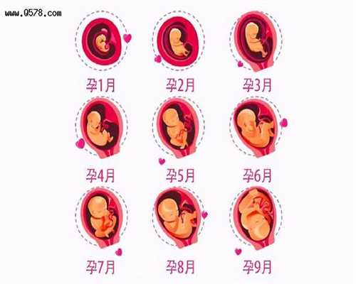 想怀二胎要注意什么取环后、剖腹产后多久才可